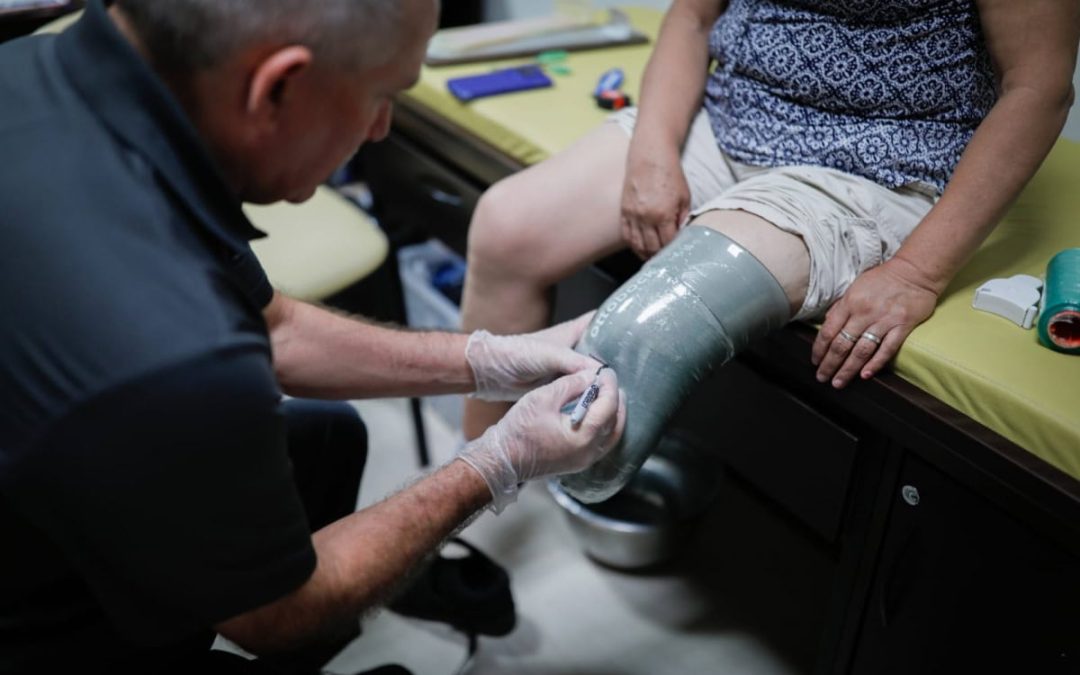 QUE REQUIEREN PRÓTESIS DE EXTREMIDADES Y APARATOS ORTOPÉDICOS EN 21 MUNICIPIOS